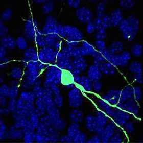 mutant-protein-spreads-through-a-neural-circuit-in-huntingtons-disease-neuron