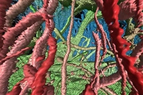 Astrocytes in a brain organoid.