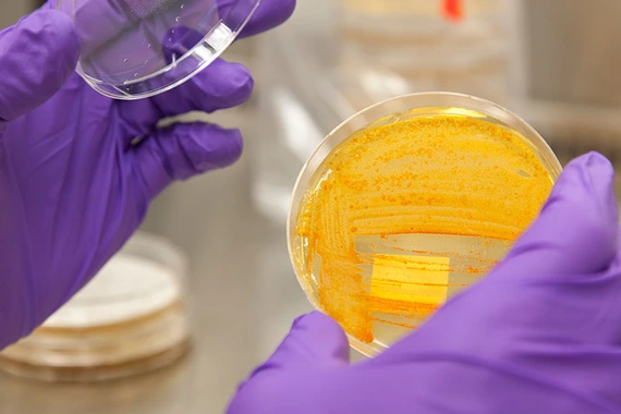 Bacteria in petri dish 