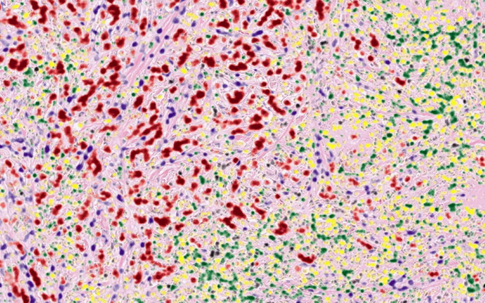 Image of pathology slide