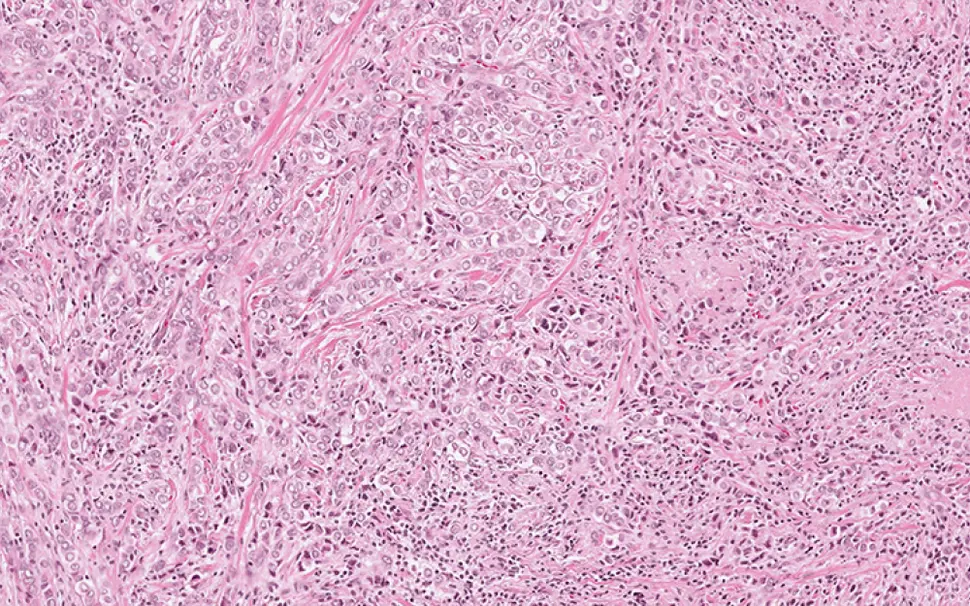 Image of pathology slide