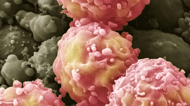 Umbilical cords yield Umbilical cords yield