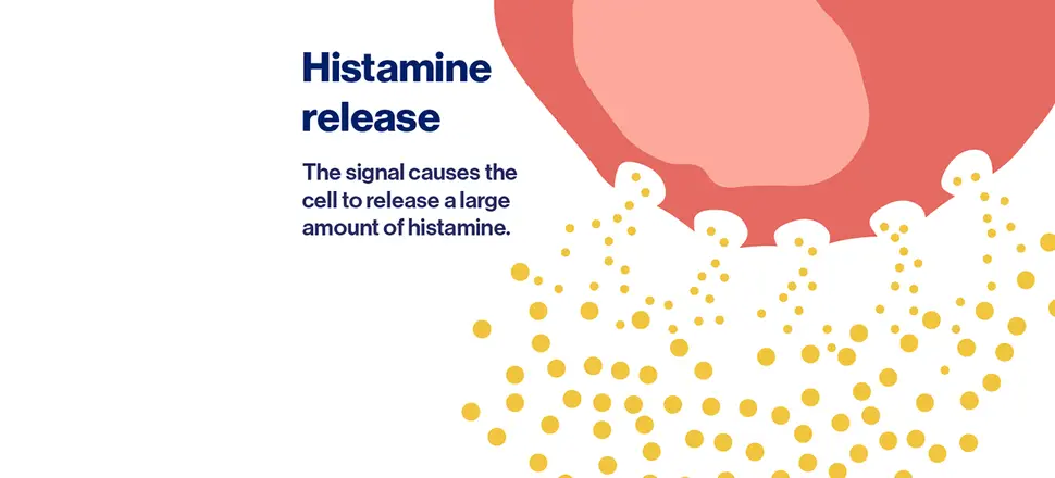 One potential cause of CSU: an overactive immune system - 3